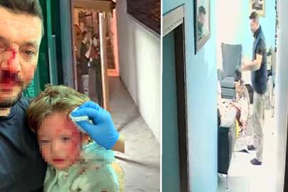 Baba ve 14 aylık kızına saldırı davası. Tutuklu sanık tahliye edildi