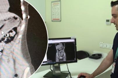 Zayıflamak isterken diş fırçası yuttu!